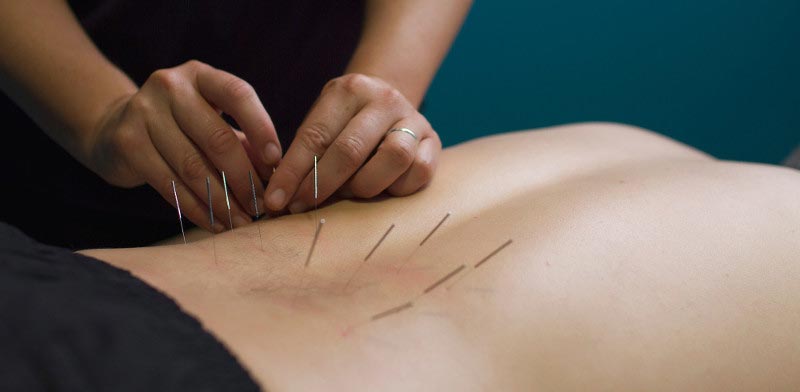 Stoddard Road Physio: Acupuncture & Herbal Medicine